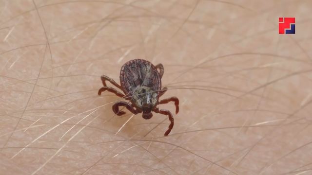 25 жителей Марий Эл пострадали от укусов клещей