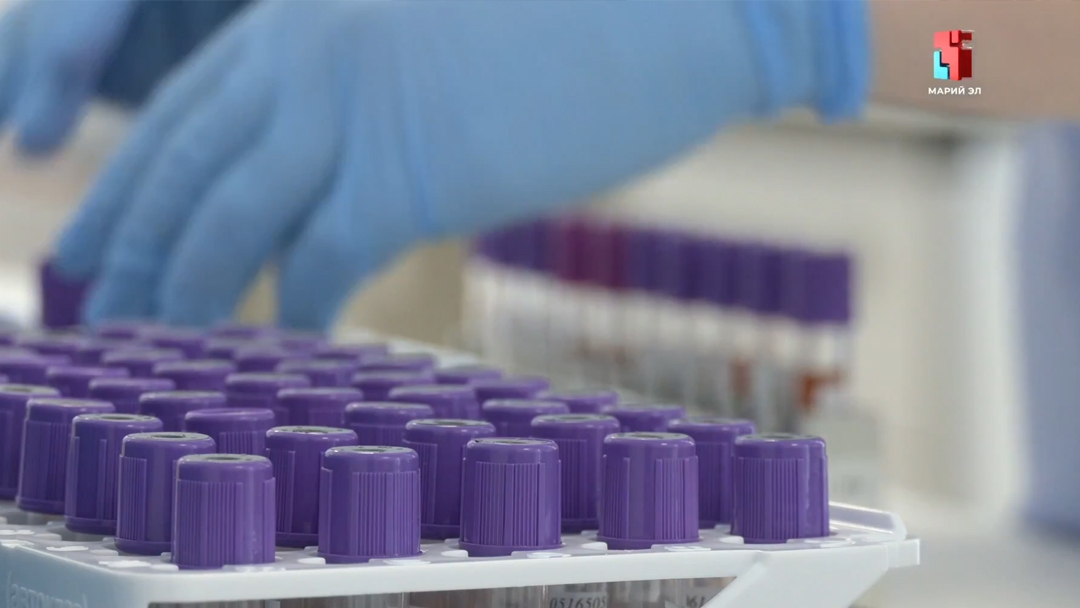 «Целый день теперь за 4 часа»: как новая лаборатория в Йошкар-Оле ускорила диагностику
