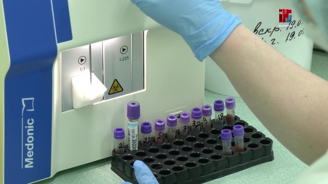 Республикысе «Вӱр налме станцийыште» 1-ше да 2-шо группо отрицательный резус-факторан вӱр кӱлеш