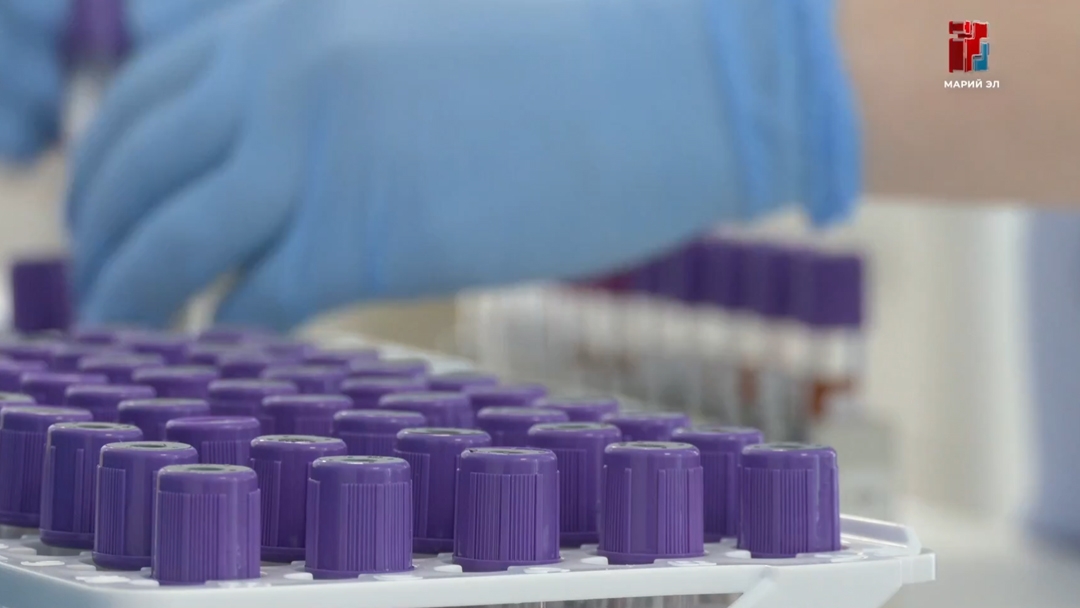 В Марий Эл заболеваемость ОРВИ и гриппом ниже эпидпорога на 40%